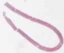 27-46a: Atypische Mycobakteriose (HE)