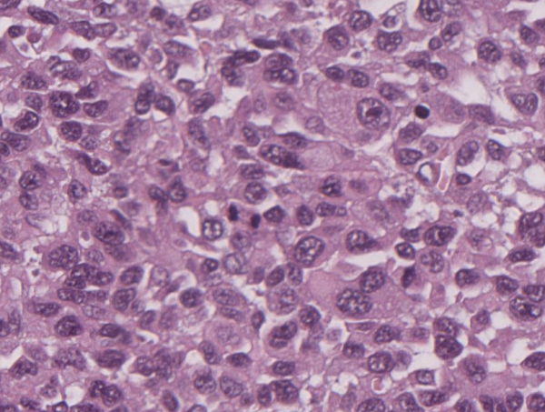 pdf Tumor Associated Fibroblasts and their Matrix: Tumor